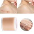 Scar Silicone Sheet Gel Patch Removal Skin Treatment Repair Wound Burn Natural