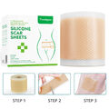 Elaimei Silicone Scar Sheet MEDICAL GRADE Scar Removal Silicone Tape Treatment